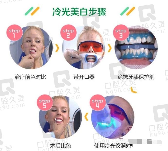 美国冷光牙齿美白的优势