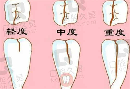 南充团圆口腔医院特色项目及技术