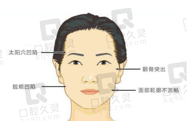 做太阳穴凹陷填充用玻尿酸填充有啥副作用？