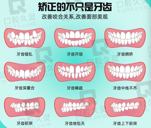 金属自锁矫正的优势