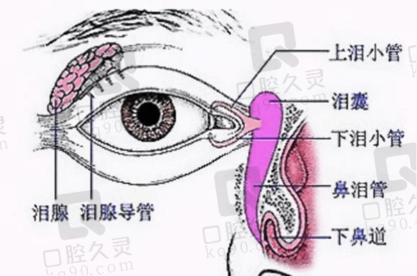 泪道阻塞好的解决方法有哪些？