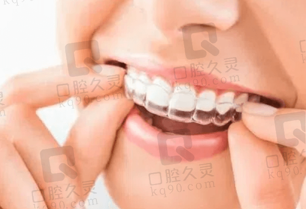岳阳牙齿矫正多少钱 岳阳牙齿矫正多少钱