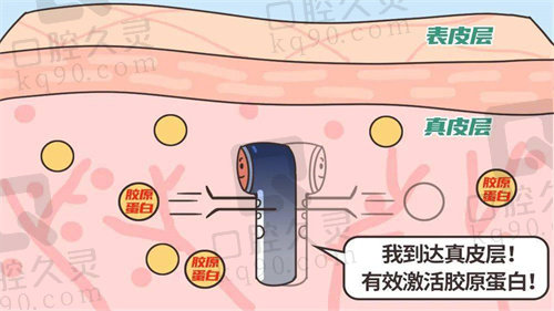 成都艺星整形医院做超声炮怎么样？