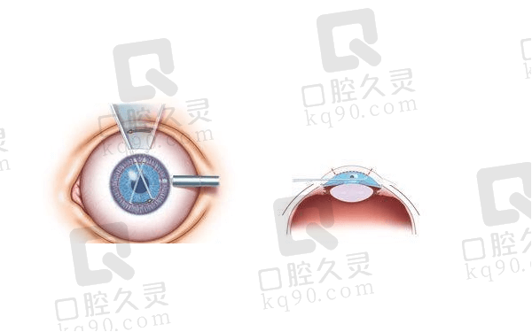 上海新视界眼科医院有几家？