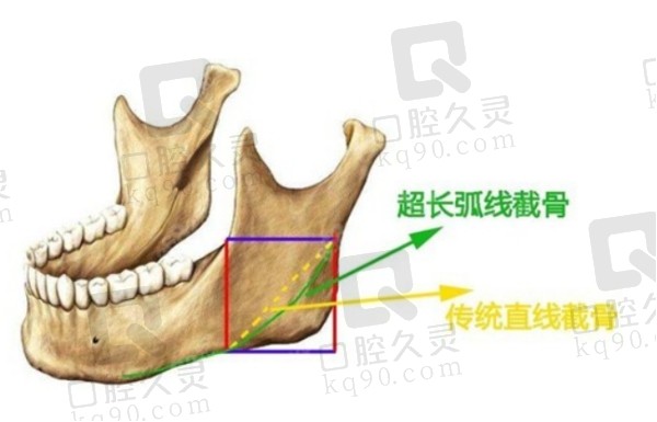 杭州时光景熙翔磨骨怎么样