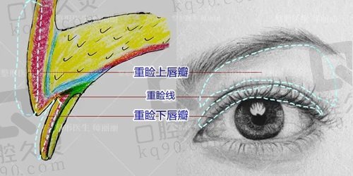 师丽丽双眼皮修复技术实力