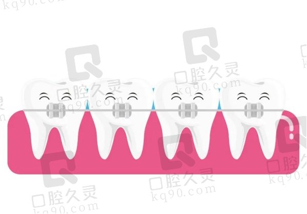 宜春牙齿矫正价格多少