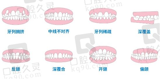 时代天使K1儿童早期适应人群