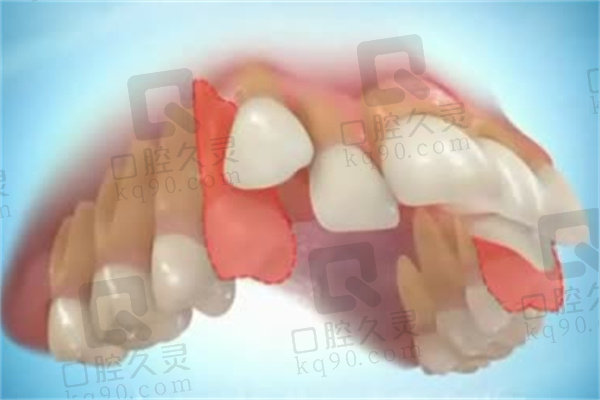 赣州方华口腔医院牙齿矫正怎么样