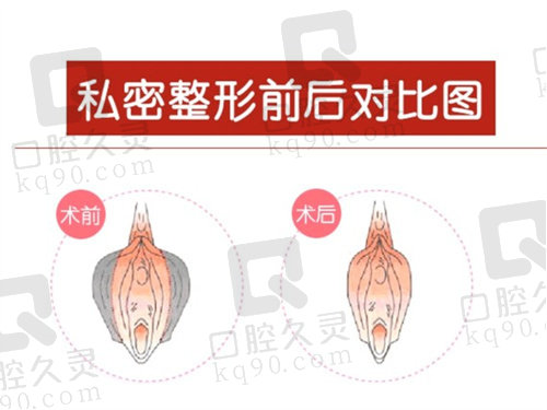 北京嘉禾私密整形价格查询