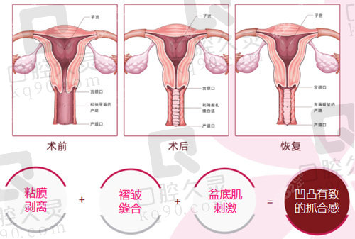 北京嘉禾私密整形价格查询