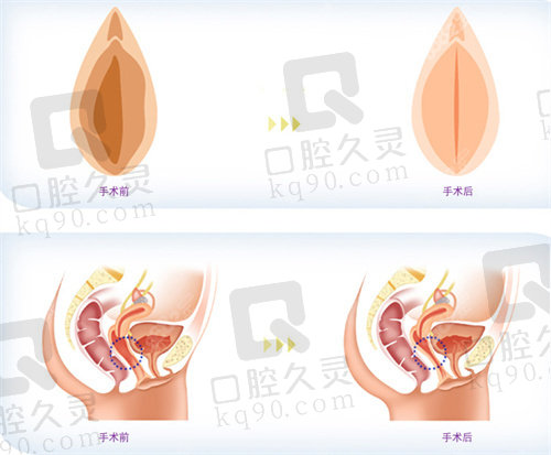 北京嘉禾私密整形价格查询