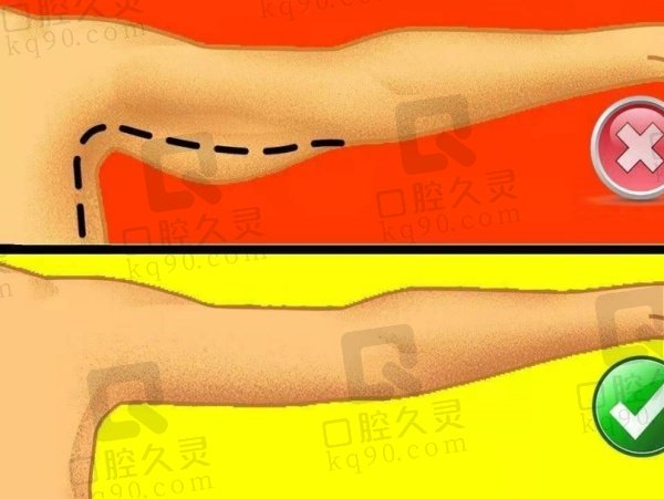 手臂环吸包括哪些部位