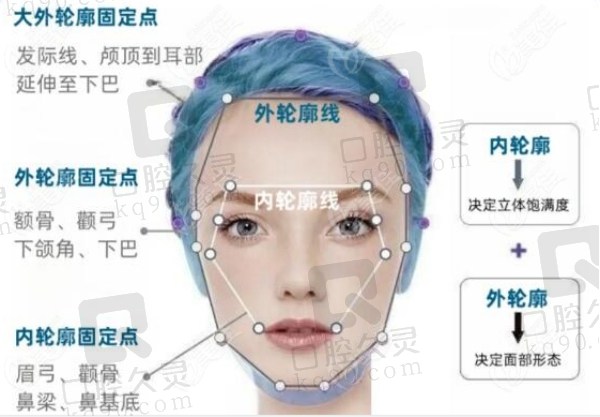 轮廓固定和面部填充的方法