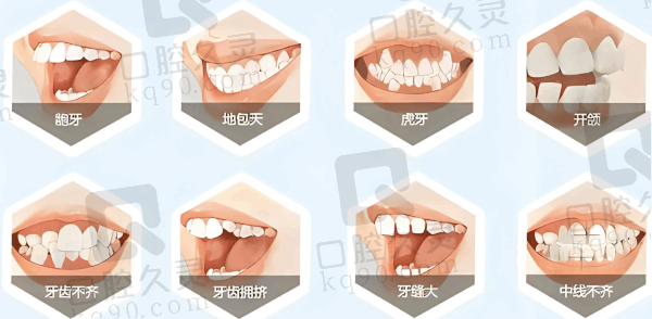 。呼和浩特市牙齿矫正医院哪里好