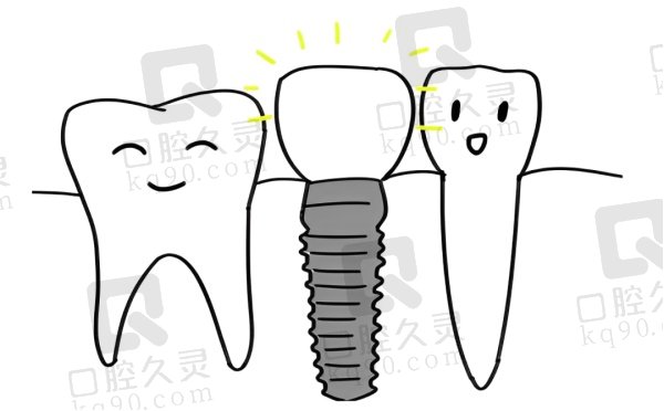 兰州皓亚口腔医院种植牙价格表