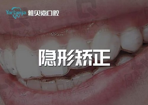 长春雅贝嘉口腔正雅隐形矫正