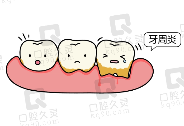 中度牙周炎可以做牙齿矫正吗