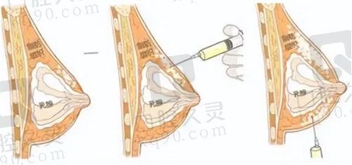 北京英煌项力源院长精纯细胞丰胸