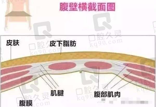 成都西区医院腹壁成形医生团队