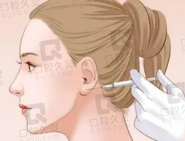 弗缦胶原蛋白填充泪沟能维持多久