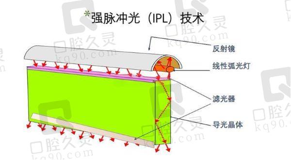 IPL（强脉冲光）治疗干眼症的疗效