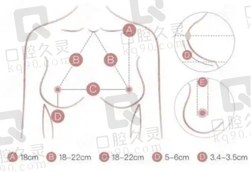 福建隆胸医生排行榜前十名