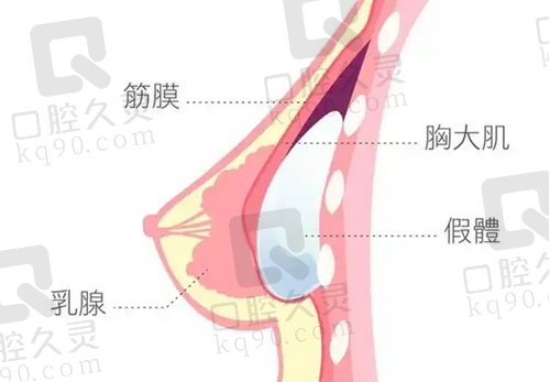 福建隆胸医生排行榜前十名