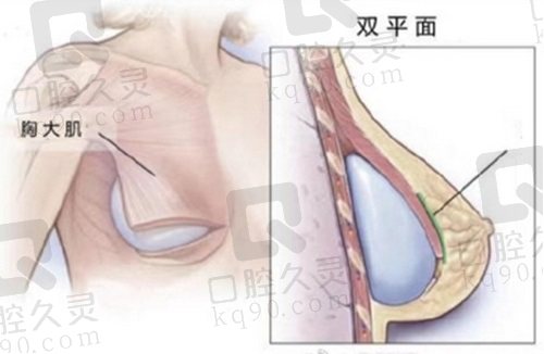 福建隆胸医生排行榜前十名