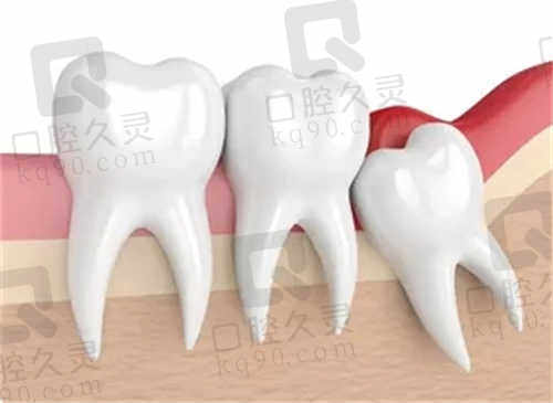 临汾恒信齿科医院部分热门手术价格