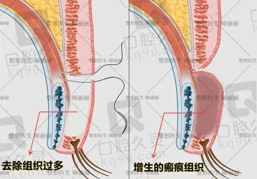 北京师丽丽双眼皮修复技术好吗