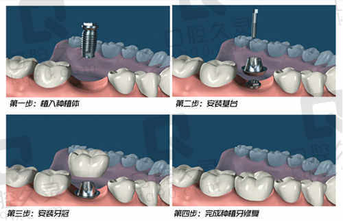 天津津领口腔诊所怎么样