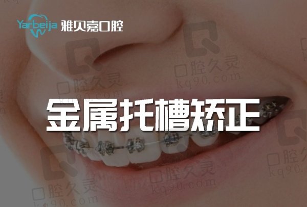 长春雅贝嘉口腔正畸价格