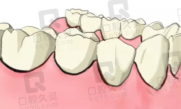 贵阳安玉口腔医院种植牙口碑怎么样