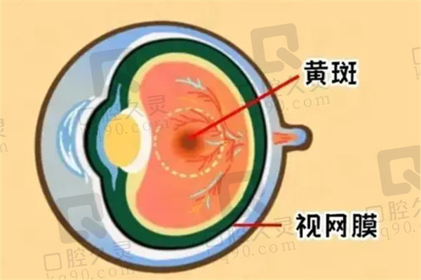 眼底黄斑病变什么原因引起的