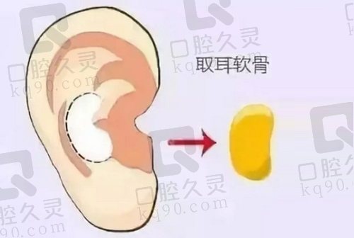 刘彦军做鼻子价格价格7w起