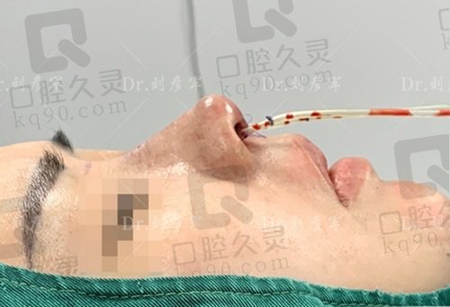 北京刘彦军做鼻子好吗？