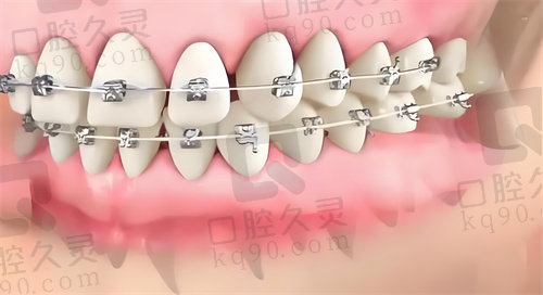青岛牙博士口腔牙齿矫正的优势