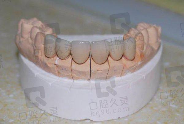 玉溪西瑞口腔镶牙医生