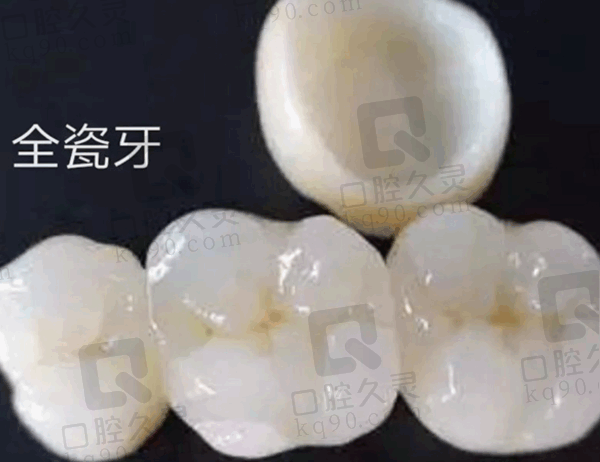 玉溪西瑞口腔镶牙怎么样