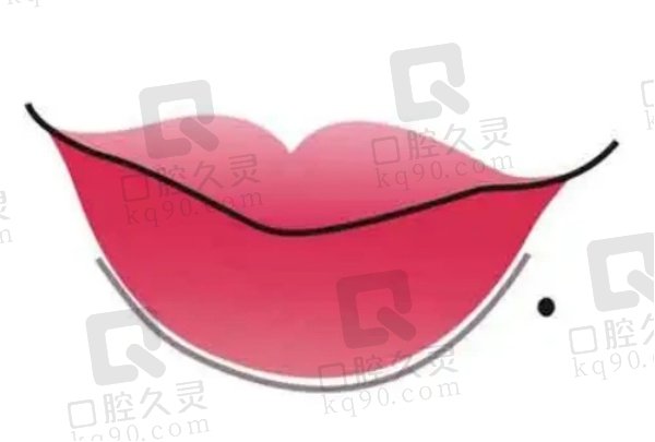 丰唇玻尿酸大中小分子用哪个