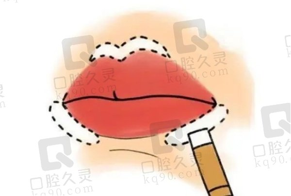 丰唇玻尿酸用什么牌子