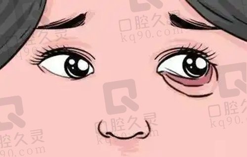 郑州东方整形贺洁院长睑外翻怎么样？