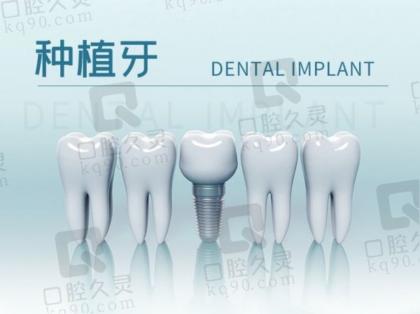 扬州牙管家口腔医院种植牙价格表