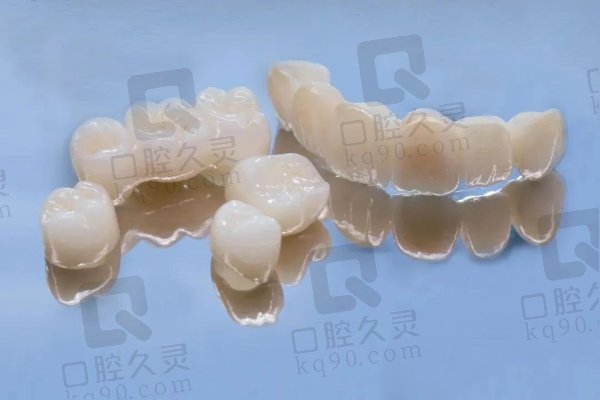 全瓷牙的特点是什么