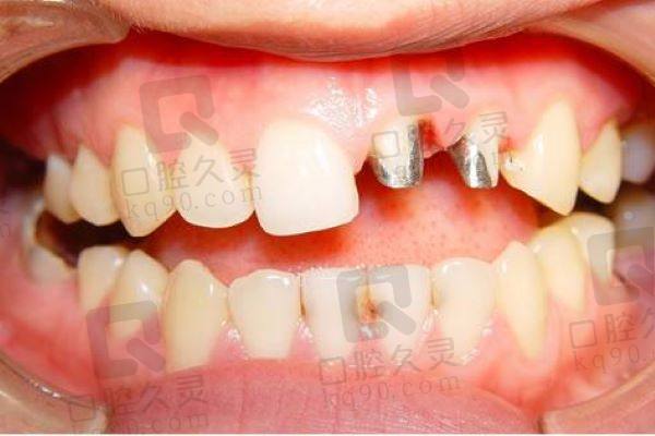 泉州美特尔口腔镶牙怎么样