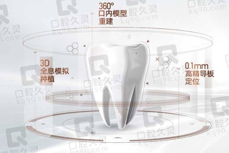 杭州团圆口腔种牙多少钱？