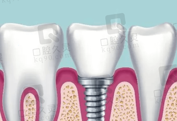 厦门思明齿道口腔种植牙怎么样