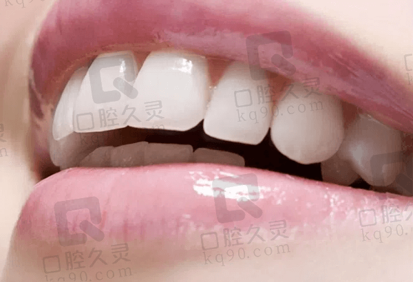 修复过程中的注意事项