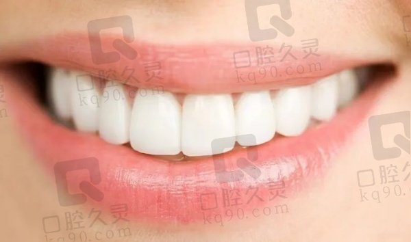 朗朗口腔皓齿美白技术的优势